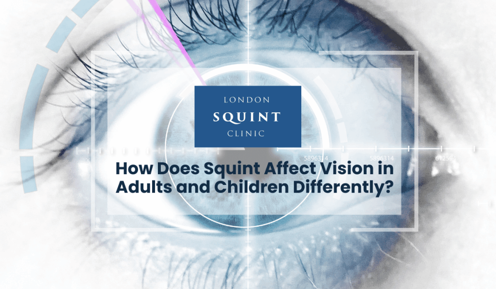 Childhood strabismus