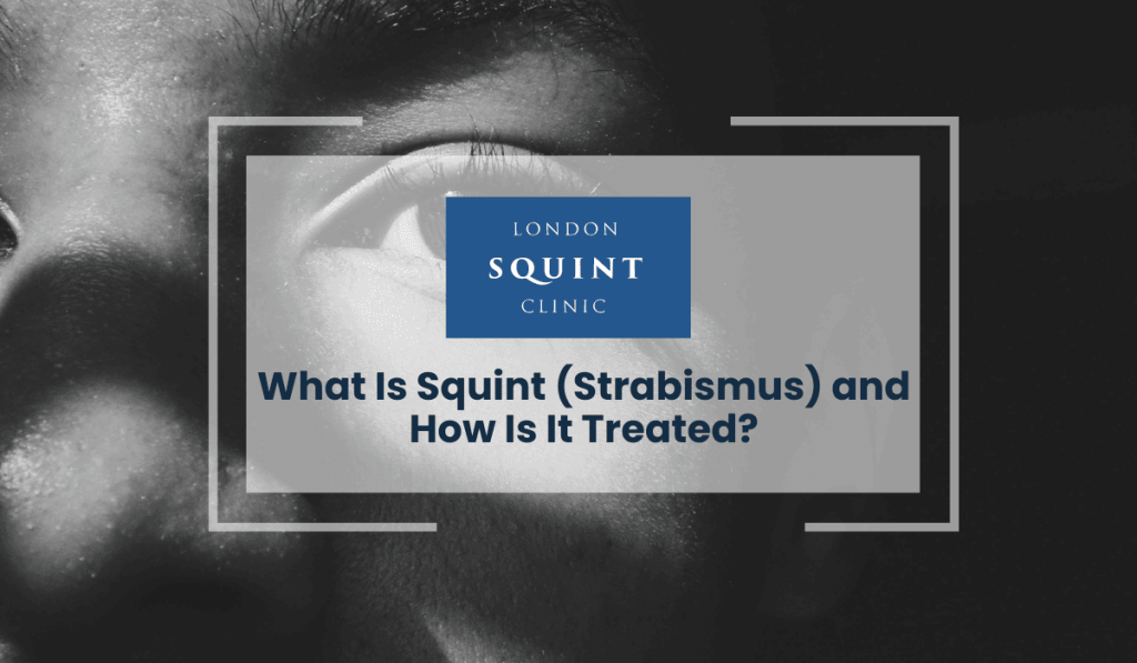 Squint Strabismus
