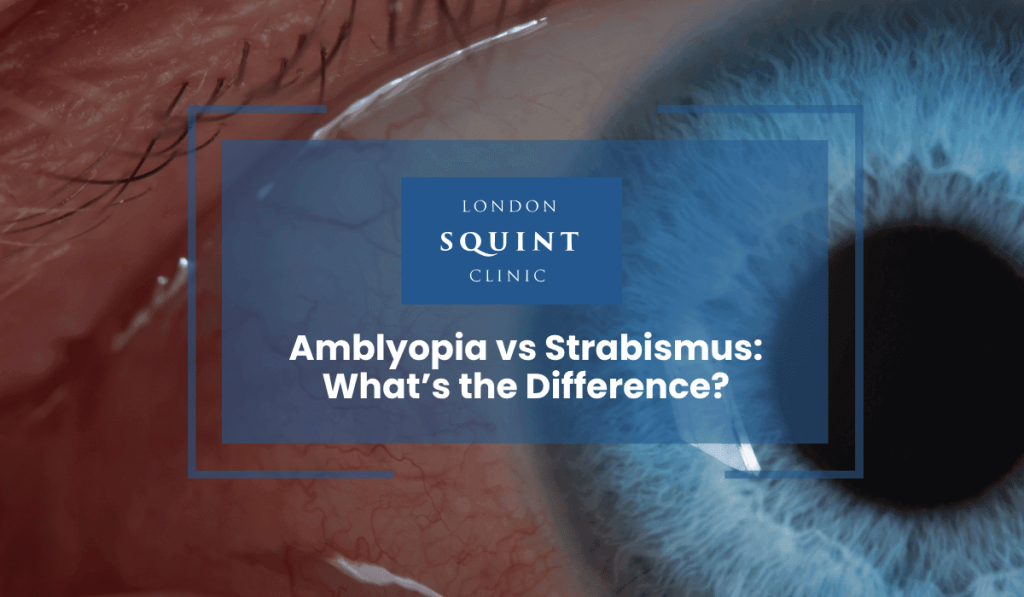 Amblyopia vs Strabismus
