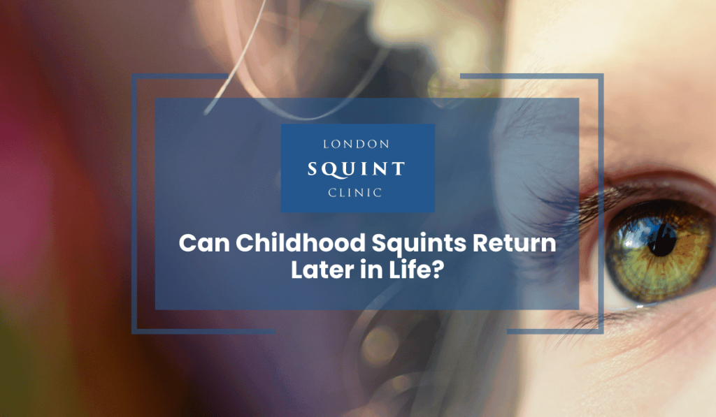 Childhood Squints london