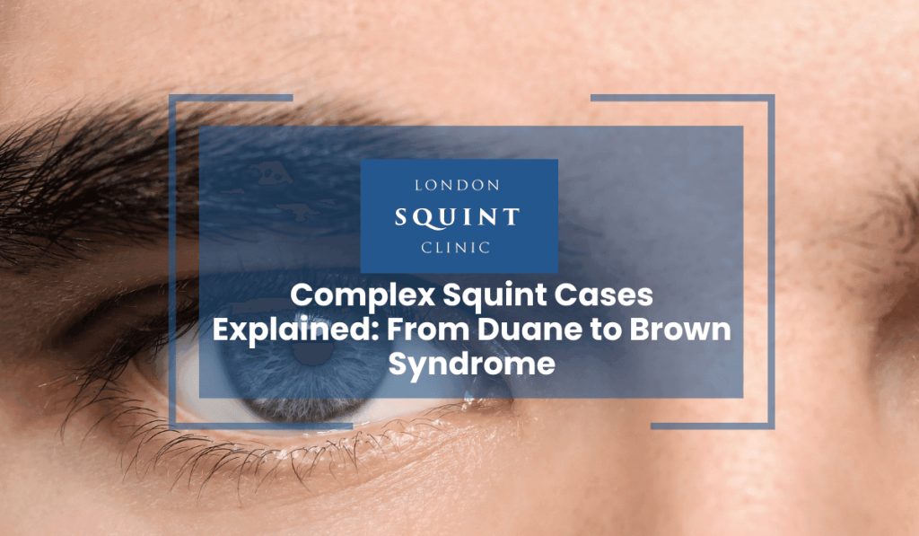 Complex Squint Cases Explained