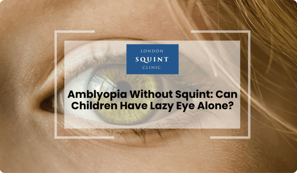 amblyopia without squint lazy eye alone 1