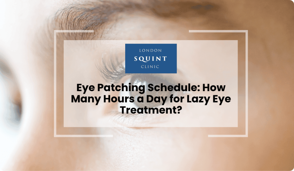 eye patching schedule hours lazy eye treatment 1