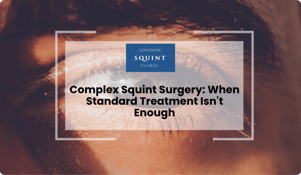 complex squint surgery advanced treatment london