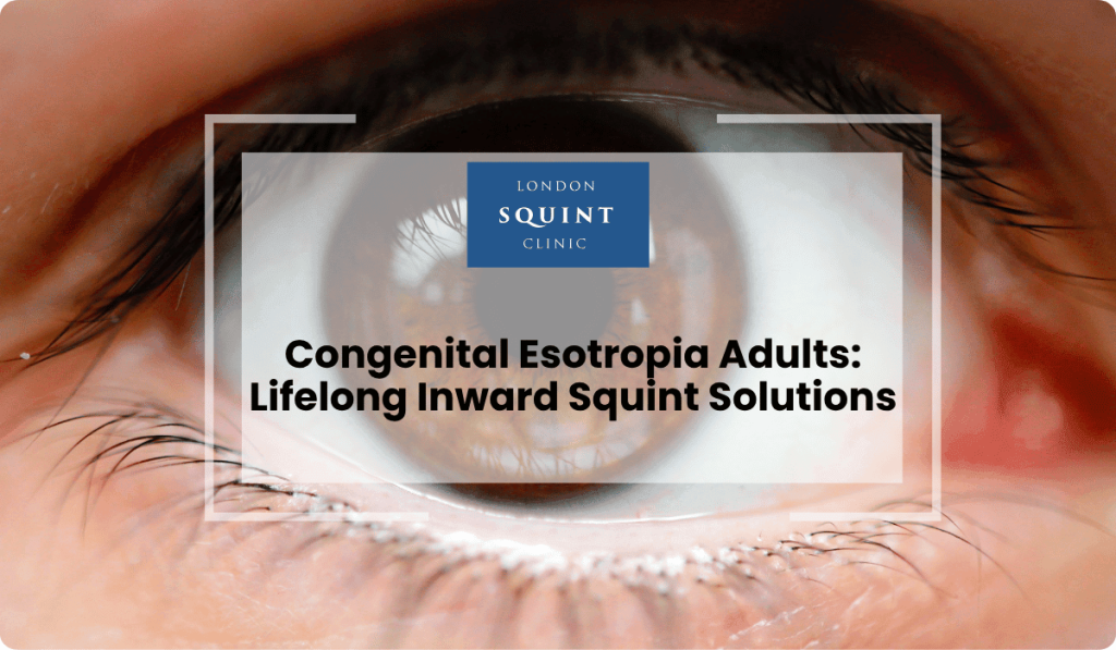 congenital esotropia adults lifelong squint solutions