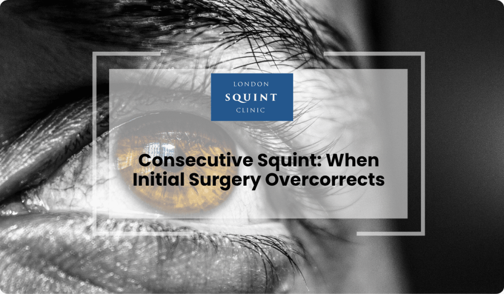 consecutive squint surgical overcorrection treatment