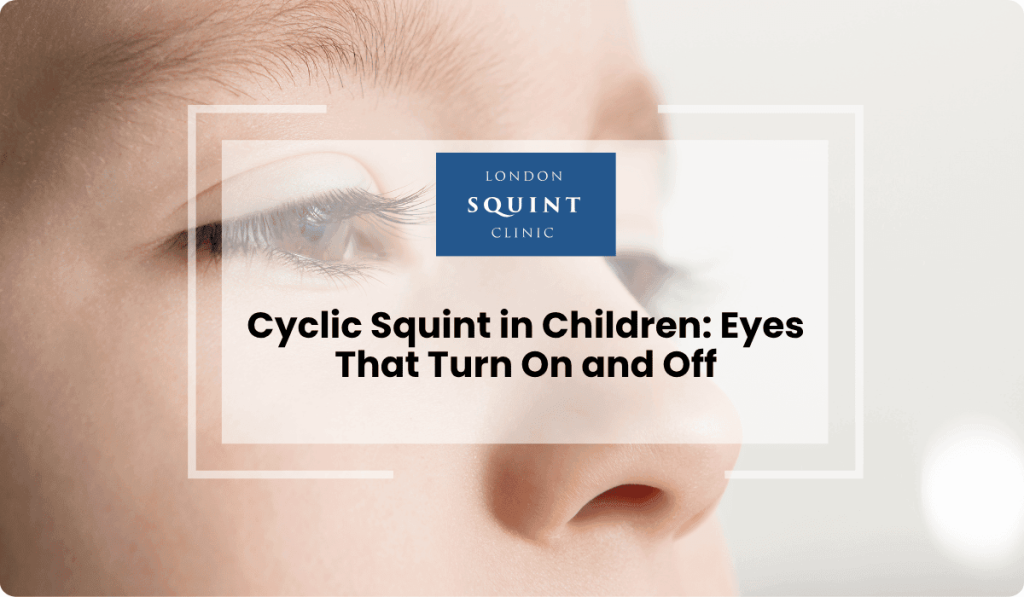 cyclic squint children eyes turn on off