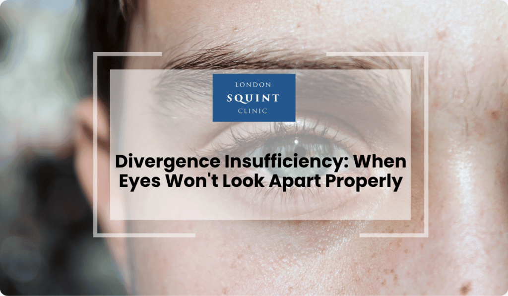divergence insufficiency eyes wont look apart