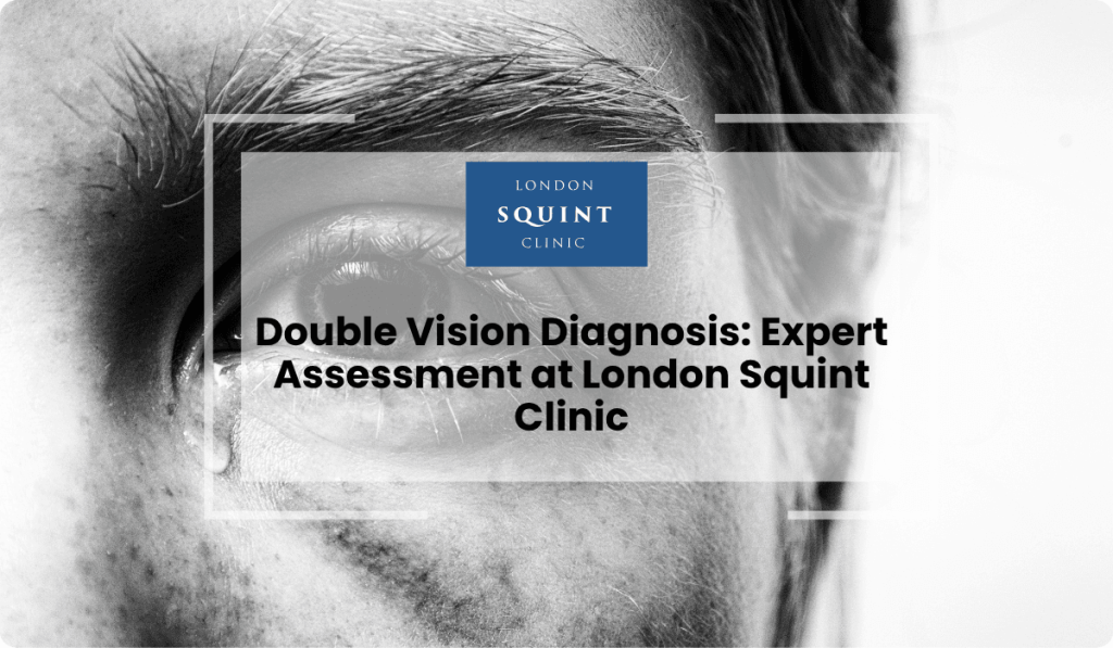 double vision diagnosis expert assessment london