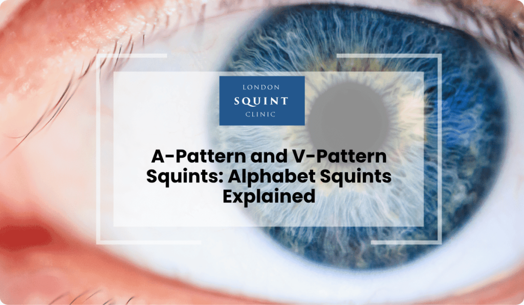 a pattern v pattern squints alphabet explained