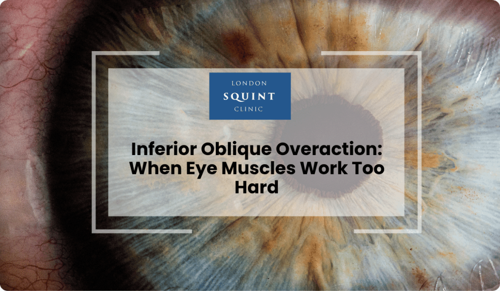 inferior oblique overaction muscles work too hard