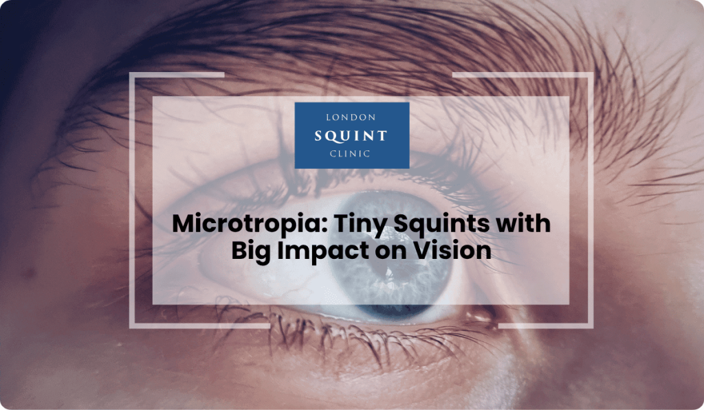 microtropia tiny squints big impact vision