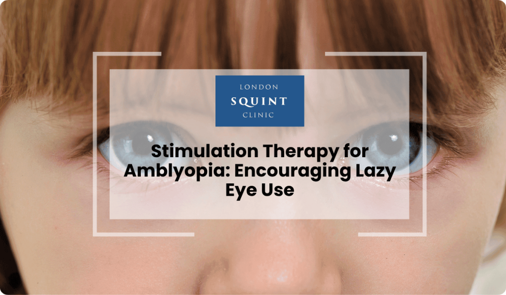 stimulation therapy amblyopia encouraging lazy eye