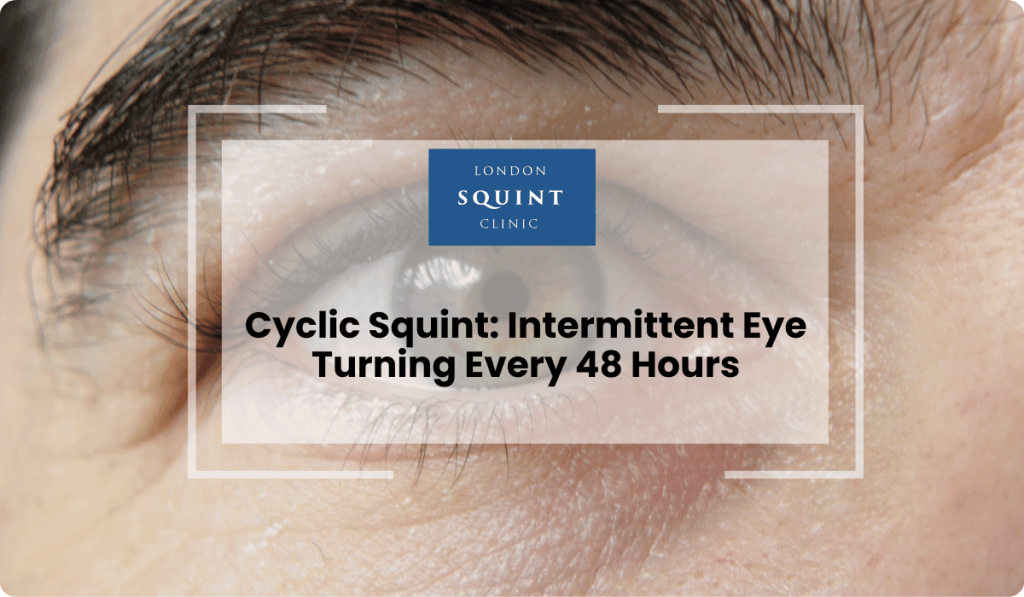 Cyclic Squint