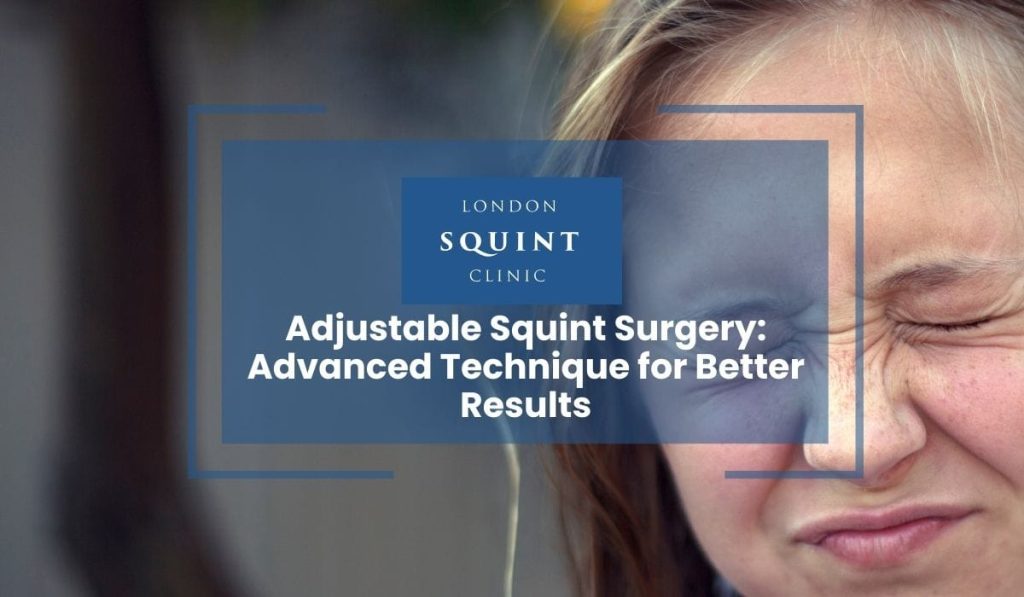 Adjustable Squint Surgery