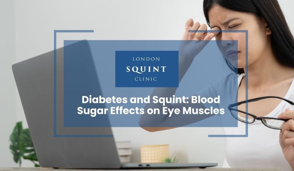 Diabetes and Squint