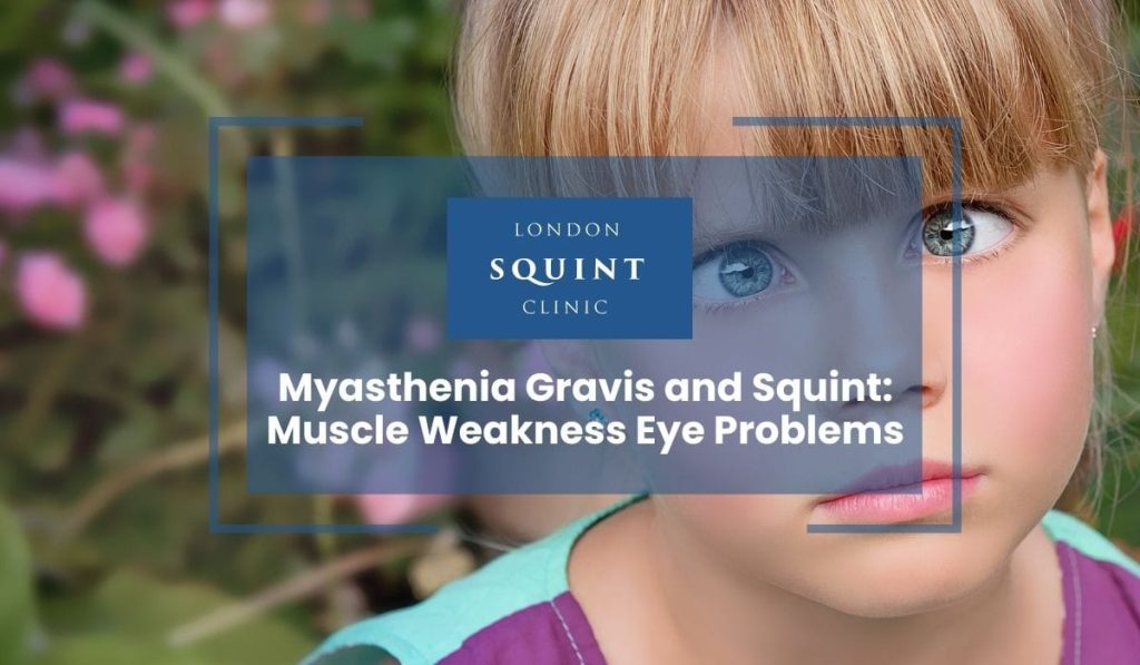 Myasthenia Gravis and Squint