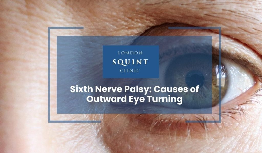 Sixth Nerve Palsy Causes of Outward Eye Turning