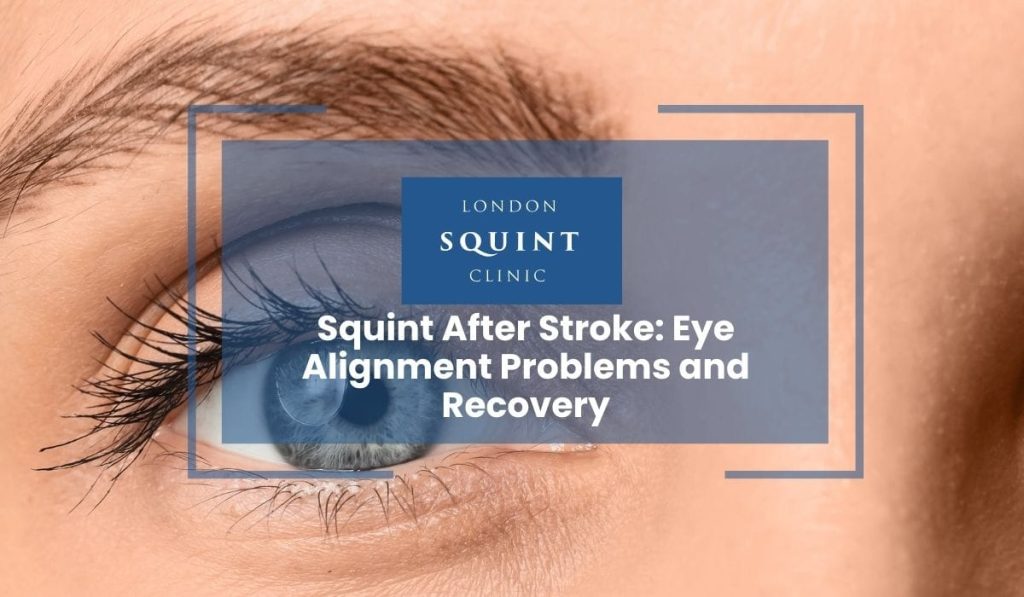 Squint After Stroke