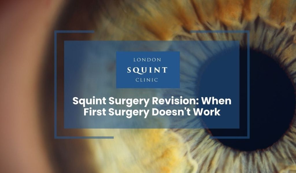 Squint Surgery Revision